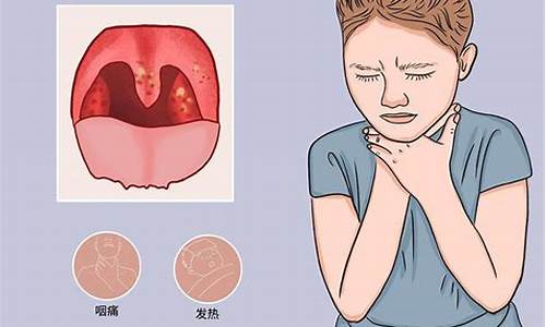 天气热为什么喉咙发痒想咳嗽_天气热为什么喉咙发痒